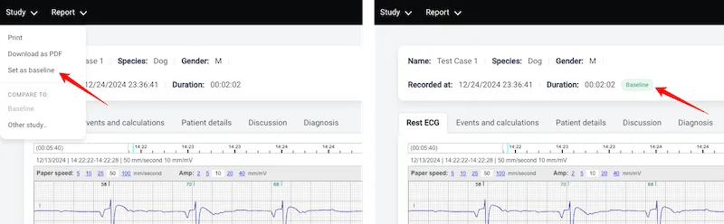 Study baseline