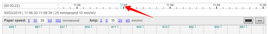 Timeline viewer
