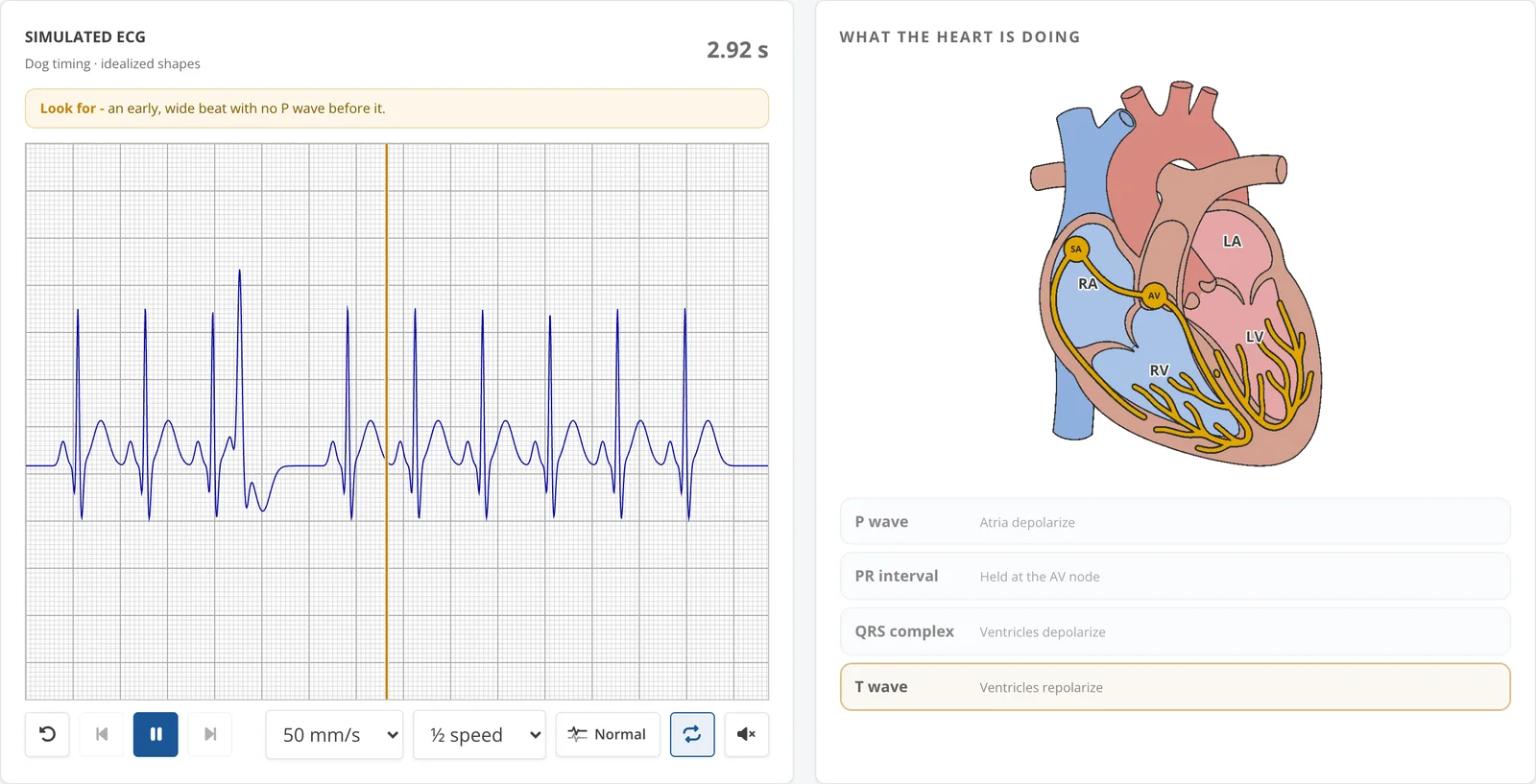 ECG Simulator playing a ventricular premature complex scenario beside a heart conduction diagram