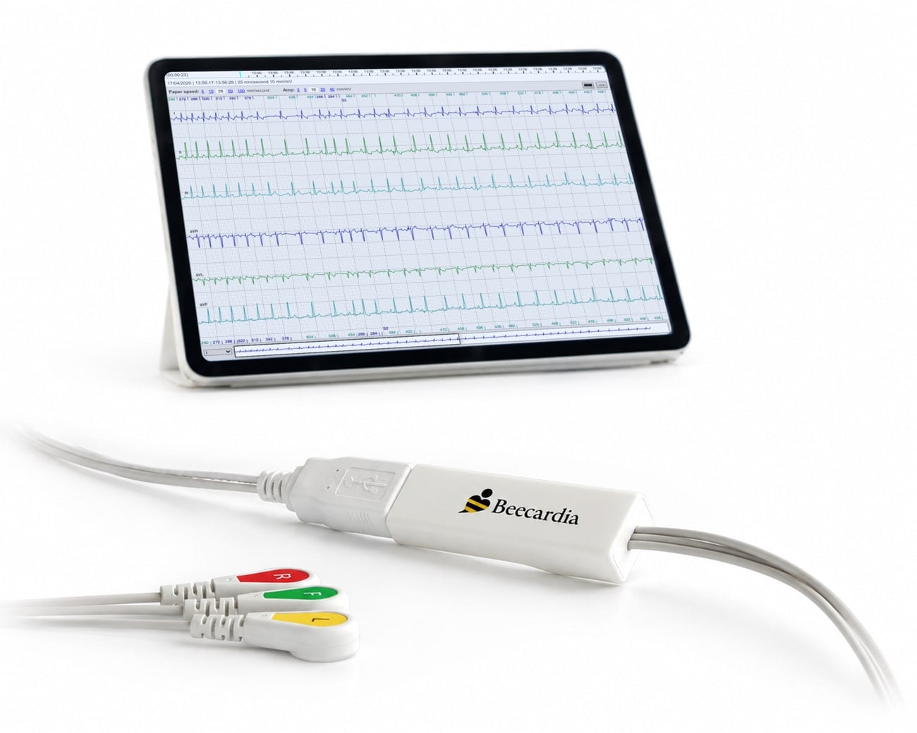 Beecardia ECG kit: tablet showing an ECG in the Beecardia viewer, the Beecardia device and three colour-coded electrodes